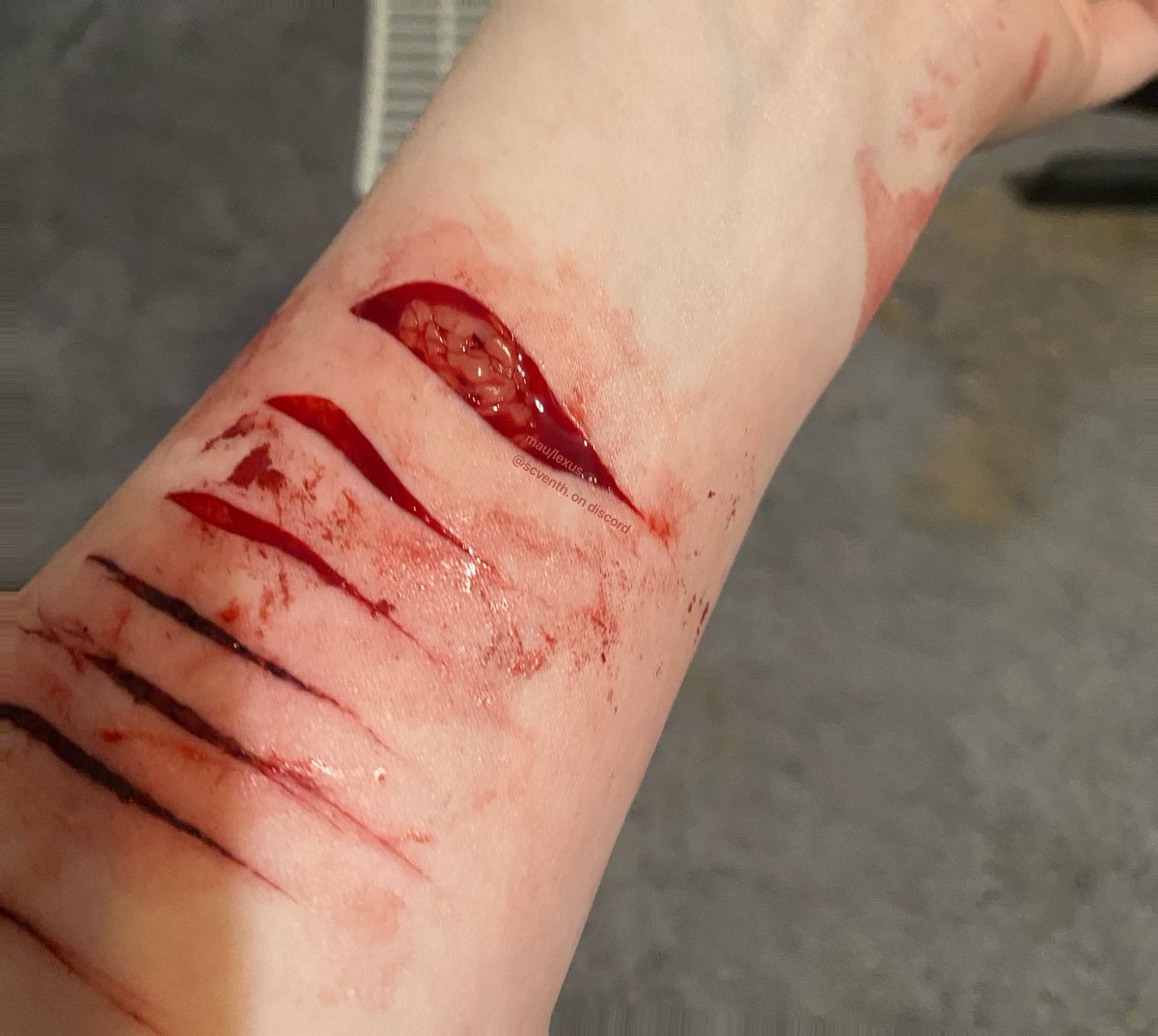 lexiiiess's tweet photo. @only_mimi2 hello, please someone help me identify what depth this is. i did it on accident and i am scared of how it may scar, or how long it will take to scar. https://t.co/tK5v8Dvf6k
