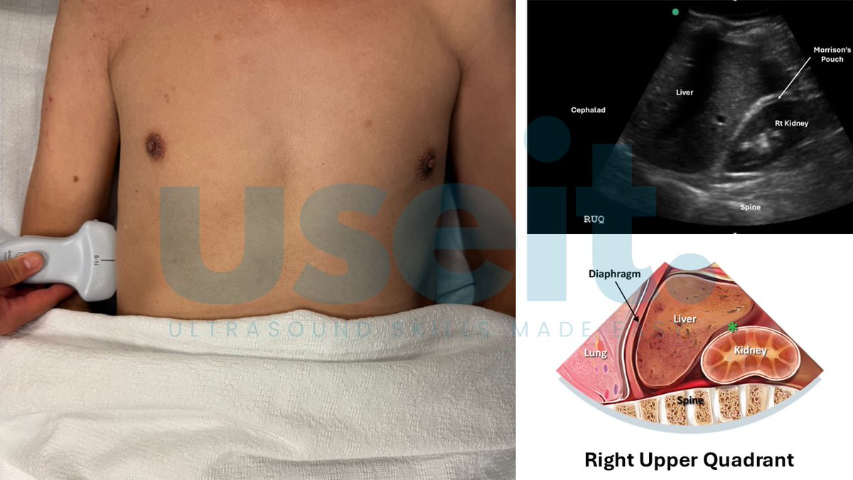 pocus.sg tweet media