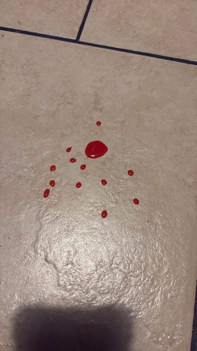 UziCryptoo's tweet image. What is dripping through my ceiling?