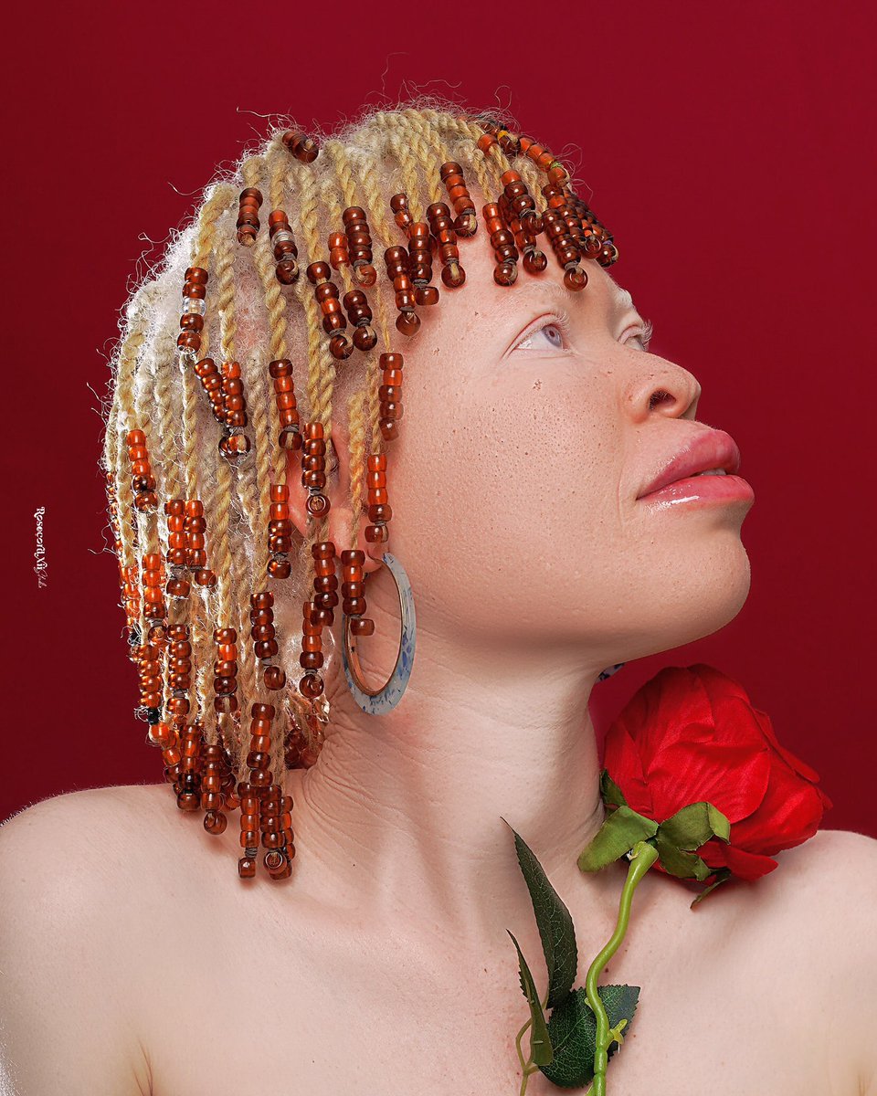 Série portrait: 30 jours 30 visages – Jour 16

Une lumière, un regard, une histoire.
👩🏽‍🦰: Opéyèmi

📞 +229 01 58336433
📍 Atrokpocôdji
©️ Rosecord XII Studio

________________________
#PortraitsDuMois #Rosecord #HumanLight #BeninPhotography #PhotoArt #CreativeSoul #StudioStory