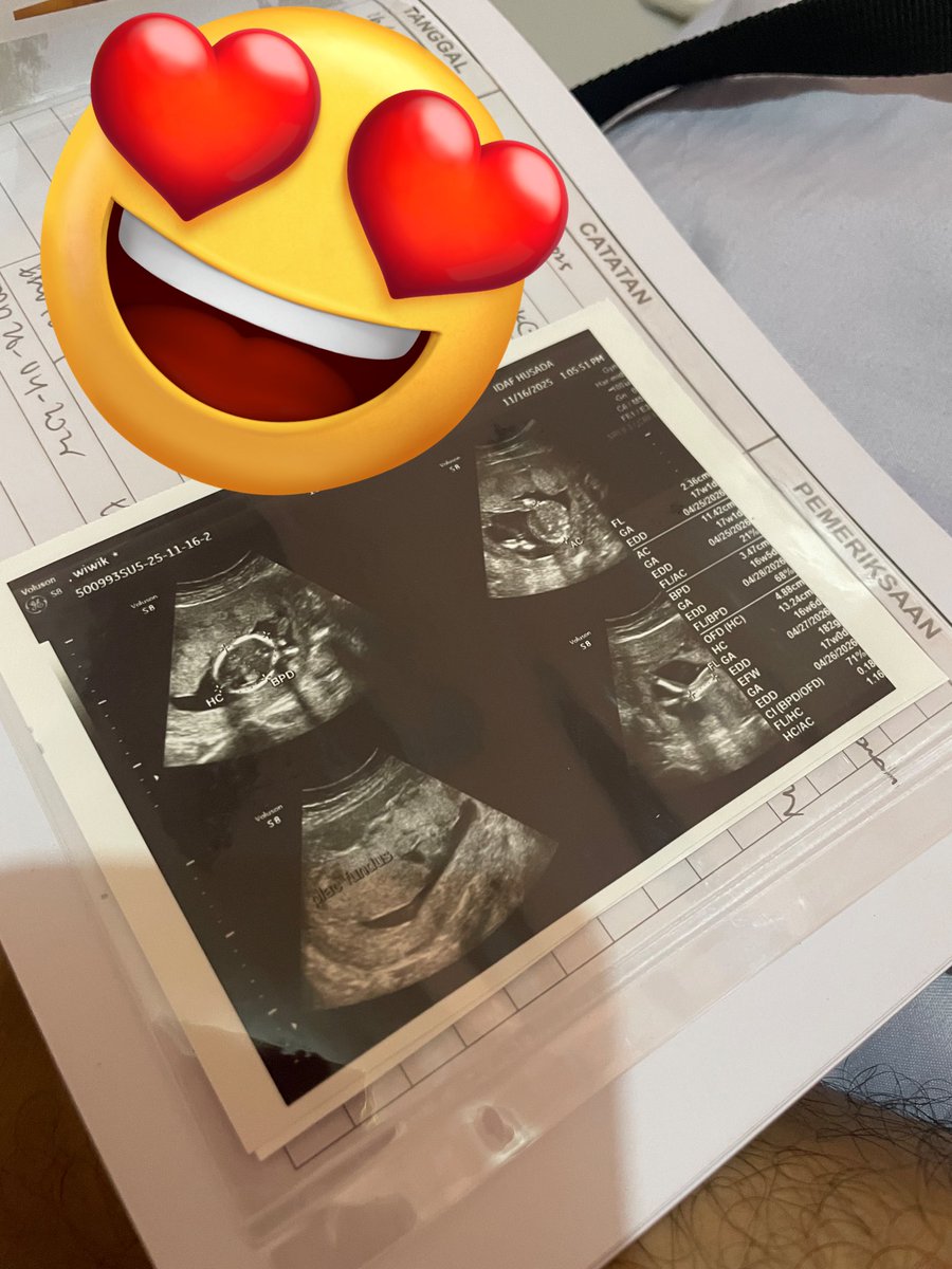 Sehat sehat sampai berojol ya