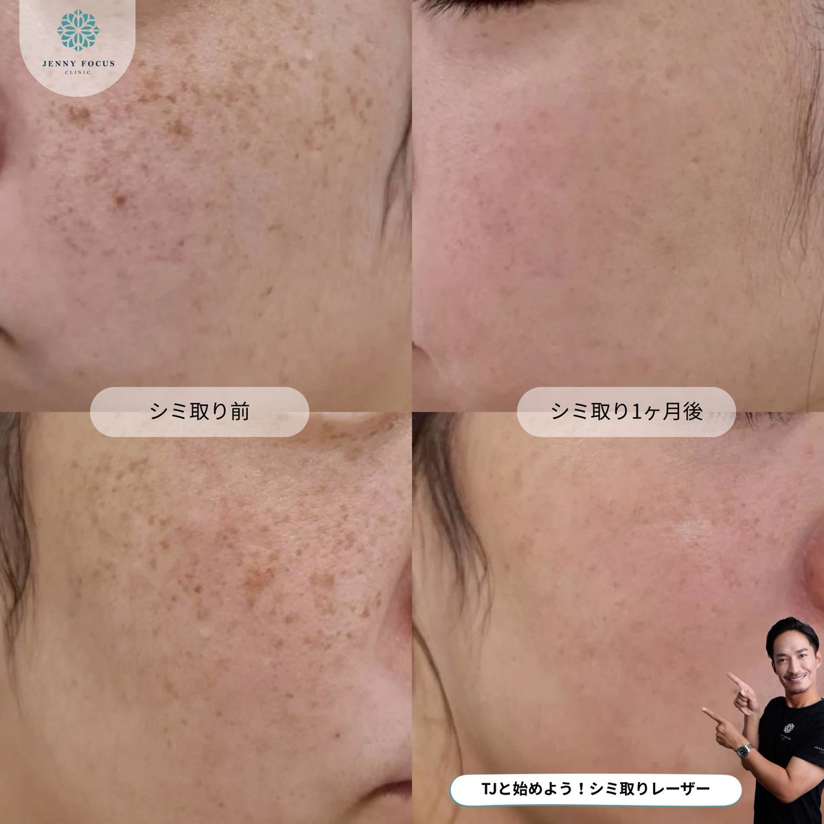 TJ ＠TJ Channel (@TJ_Bangkok) / Posts / X