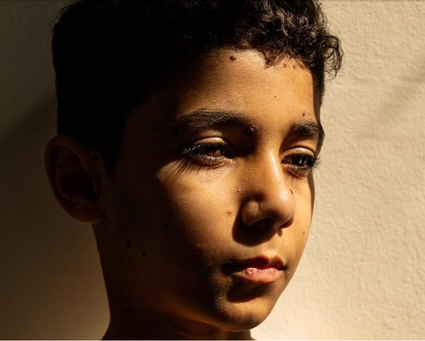 Plenainclusion's tweet image. 📸 Una exposición en Barcelona muestra las mejores fotos del World Press Photo 2025, un certamen mundial que reconoce a las mejores fotos que cuentan noticias reales. 

🗞️ En #LecturaFácil, te contamos más sobre esta exposición en #PlanetaFácil:
planetafacil.plenainclusion.org/una-exposicion…