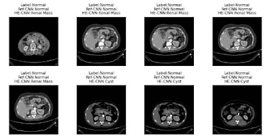 Radiology_AI's tweet image. Privacy-preserving deep learning inference using homomorphic encryption for renal mass classification on CTs doi.org/10.1148/ryai.2… @AsanMedicalCtr #DeepLearning #DL #HomomorphicEncryption