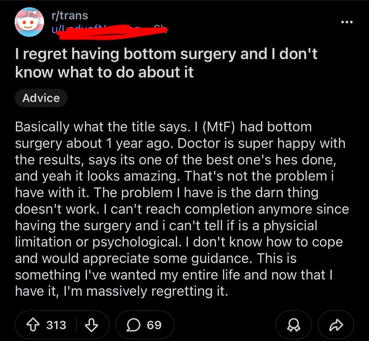 reddit_lies's tweet image. Modern day lobotomy.