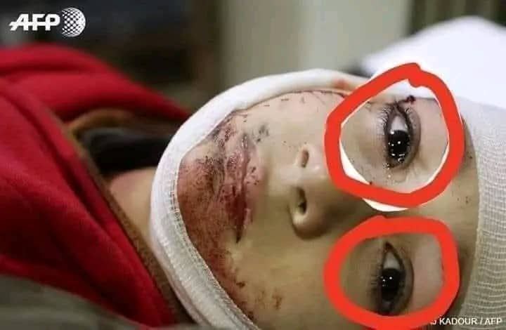 دا هغه سترګې دي چې ټول
 مسـ..لمه اُمـ،.ت نه ګېلمنې دي

💔😭#Gaza
<a href="/UmarQalander313/">UᵐᵃʳQᵃˡᵃⁿᵈᵉʳ/عمر قلــندر</a>