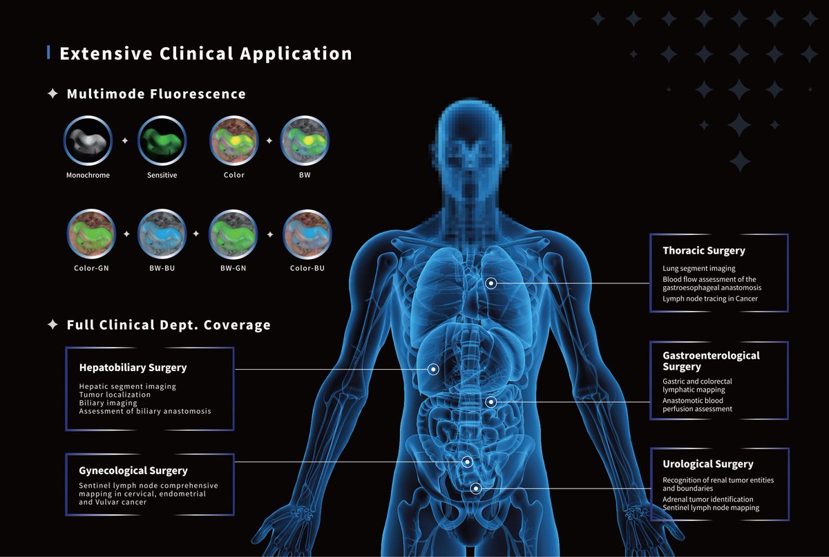 Toumai® Surgical Robot Fluorescence Imaging System Receives EU CE Certification

The DFVision™ 3D Fluorescence Electronic Endoscope, the component of the Toumai® Surgical robot vision system, has received CE certification. 
#Toumai #robot #ICG