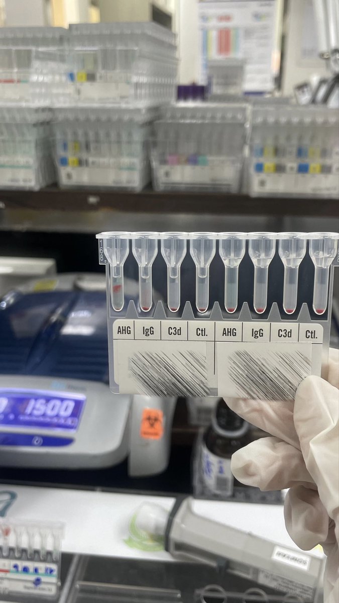 Blood Bank – Gel Card Testing ✨