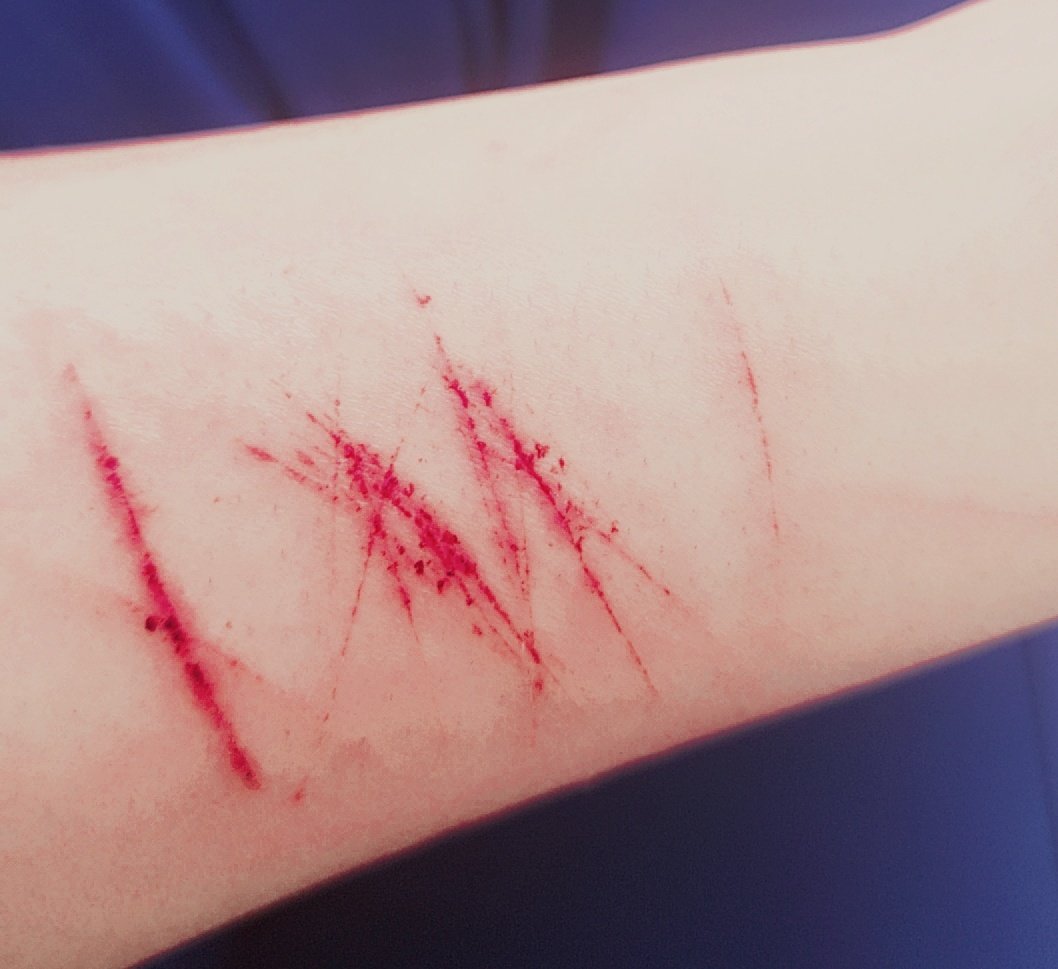 devest_o's tweet image. I deserve to bleed. :P

#shtwt #shedtwt #subtwt