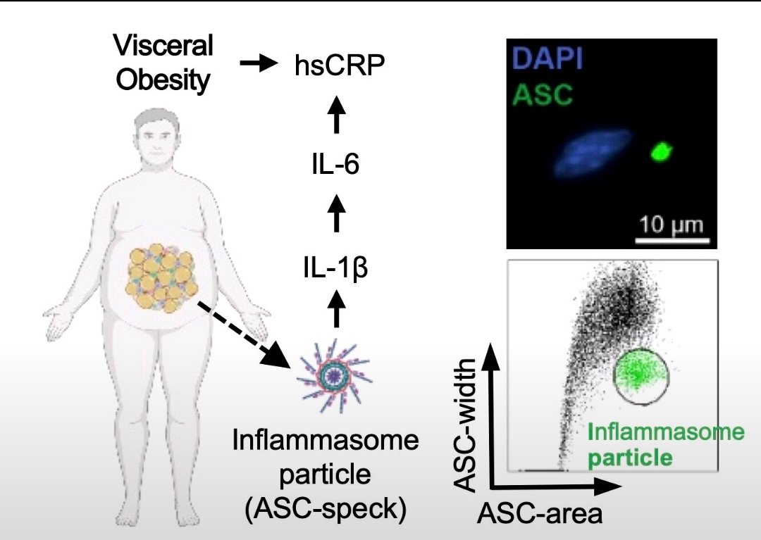 Externalized Inflammasomes in Visceral Fat Sustain #Obesity-Related #Inflammation <a href="/CircRes/">Circulation Research</a> ahajournals.org/doi/10.1161/CI…