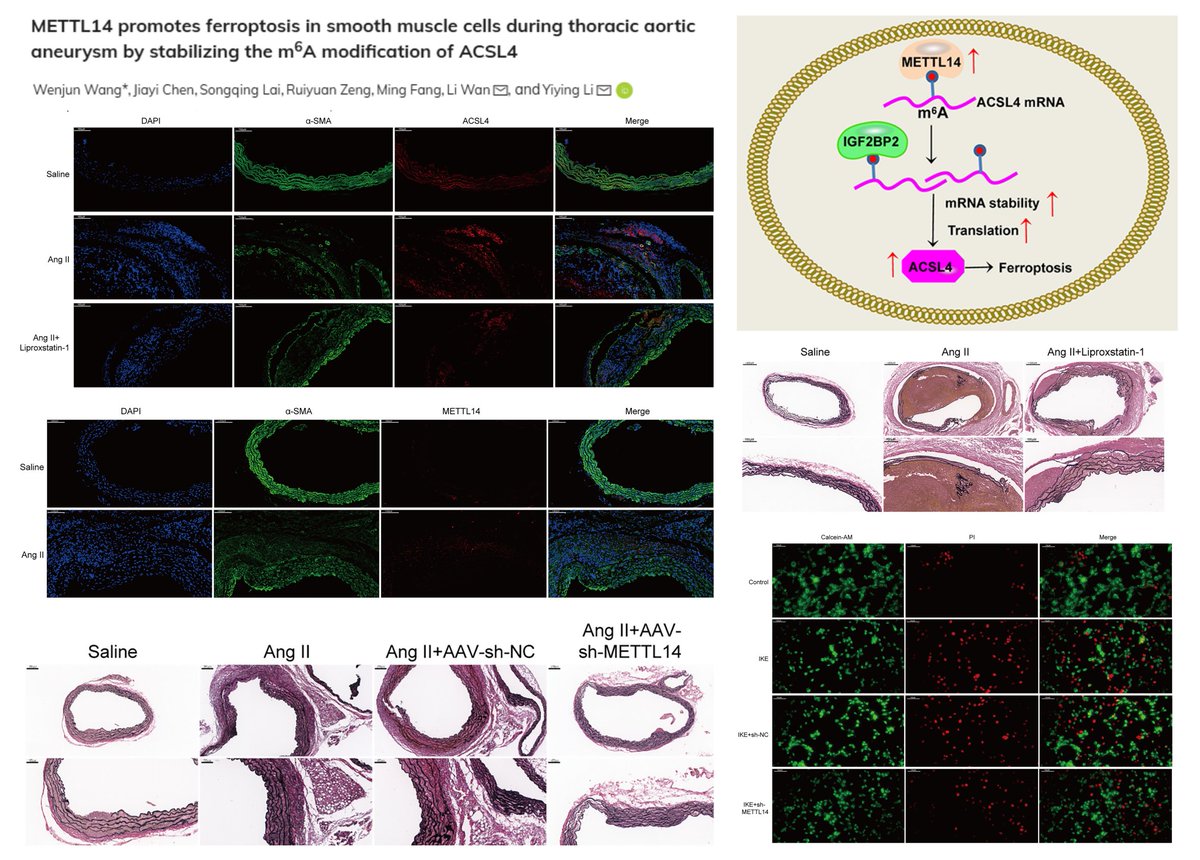 HaoYin20's tweet image. #SmoothMuscleCell m6A Epitranscriptomics

METTL14 ⬆️in 🐭#ThoracicAorticAneurysm (AngII + HFD) or erastin-treated SMC

Liproxstatin-1 or AAV-shMettl14 rescues 🐭TAA

METTL14-IGF2BP2 stabilizes ACSL4 mRNA➡️
SMC #Ferroptosis

SRAMP/deepSRAMP: m6A site prediction

@AJPCellPhys 2025…