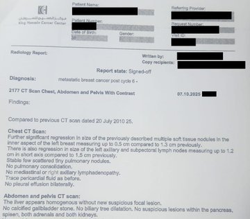 Fa21519230's tweet image. 🚨NUEVO ARTÍCULO: Testimonio sobre IVERMECTINA y MEBENDAZOL - Mujer de 37 años en JORDANIA con cáncer de mama en estadio 4 y metástasis ganglionares y óseas informa después de 3 meses: reducción de los tumores
HISTORIA:
Mujer de 37 años en Jordania con cáncer de mama en estadio 4…