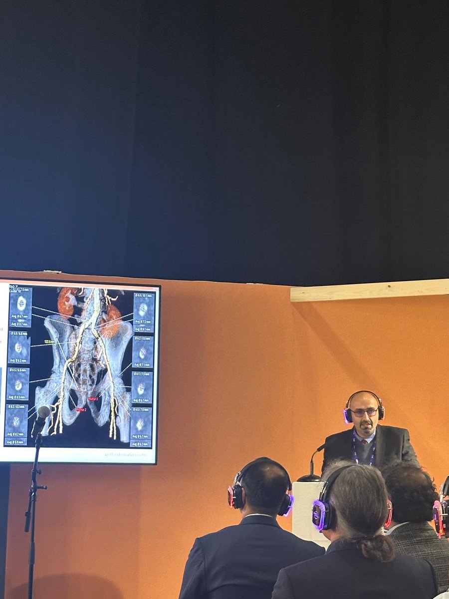 drahmedayuna's tweet photo. It was my please to present our case at #PCRlondonvalve 2025, great course to learn, teach, share ideas and experience, connect and network with colleagues from all over the globe #PCR Thanks for the organisers https://t.co/fEkxGb7B9f