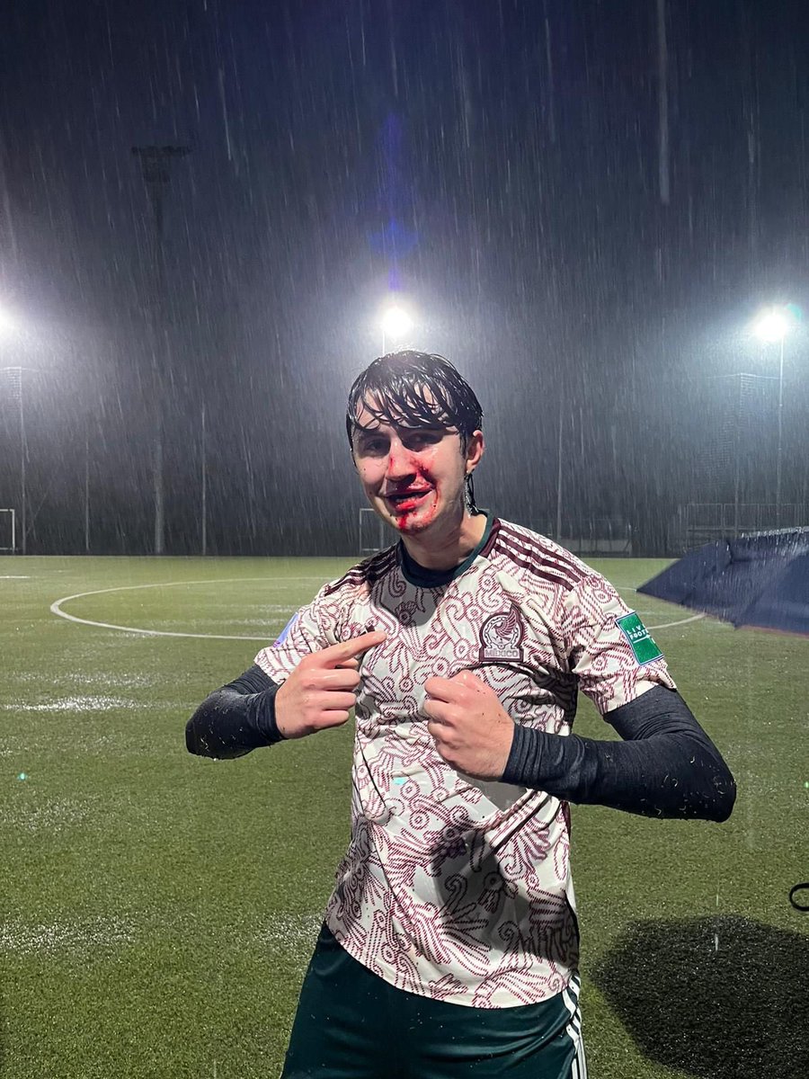 uomoperoni's tweet image. non si può neanche fare un calcetto @fumomen111625 ❤️