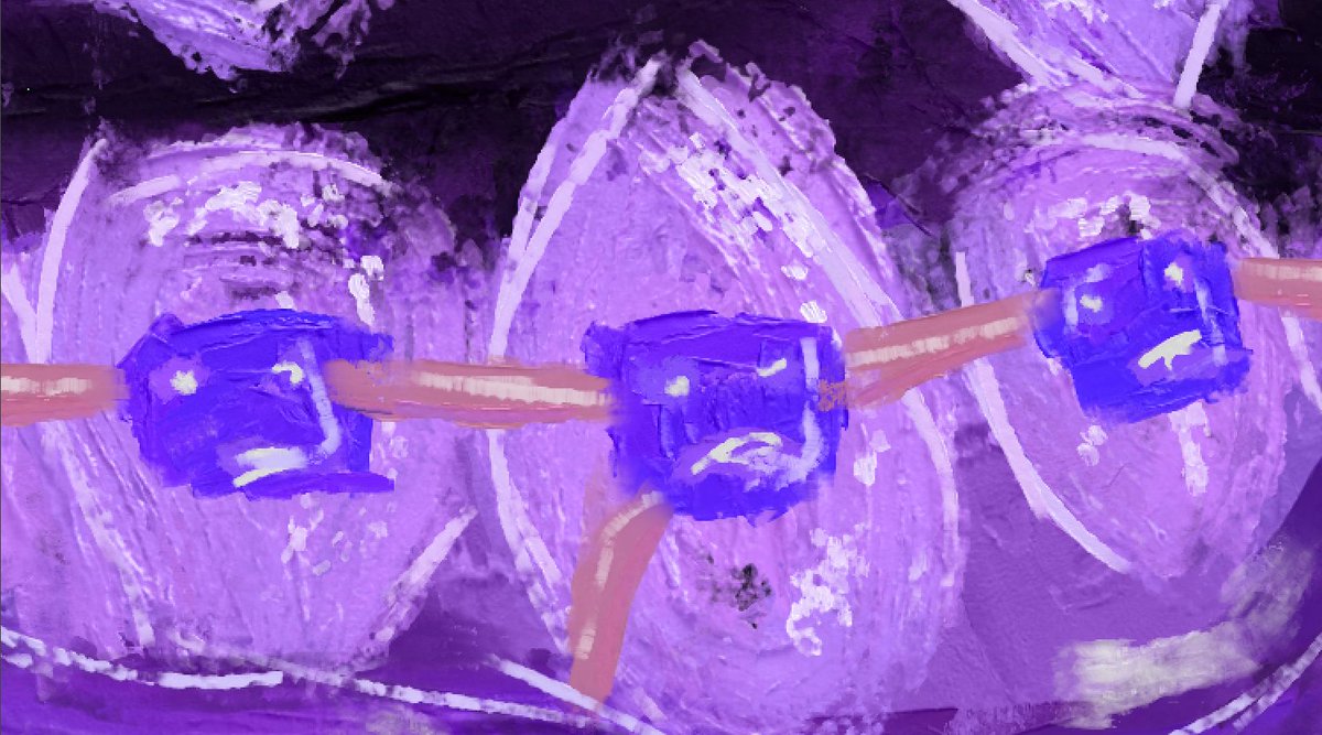 Sad little braces study 😞