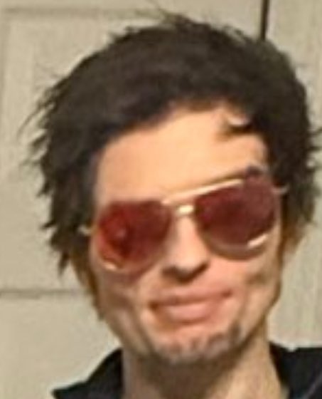 Alex B stays looking like complete DOG SHIT