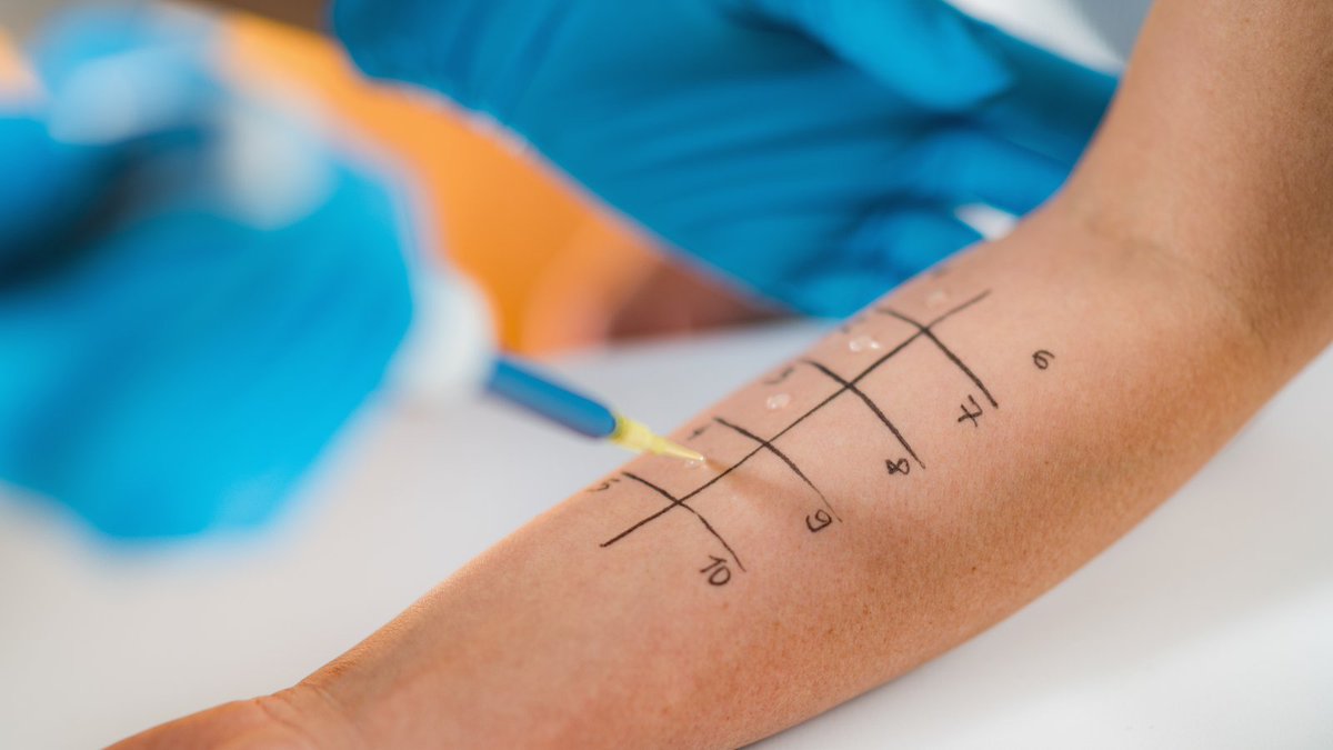 National Allergy Centre of Excellence tweet media