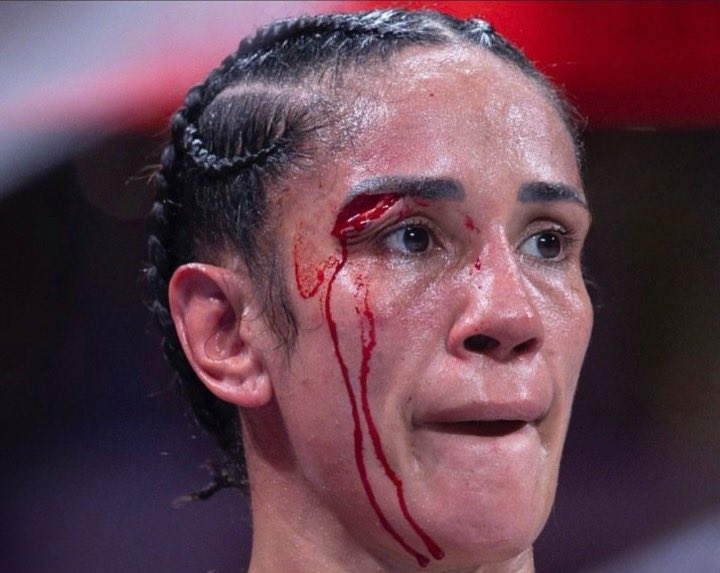 Amanda Serrano tweet media
