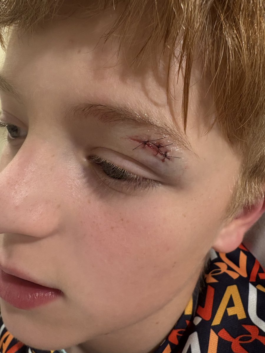 bob hommerbocker tweet media