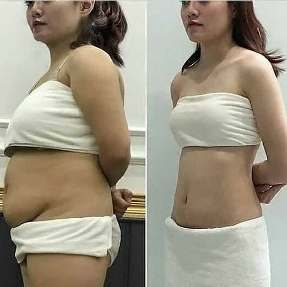 thinfruit's tweet photo. before &amp; afters https://t.co/79jEEqmRLO