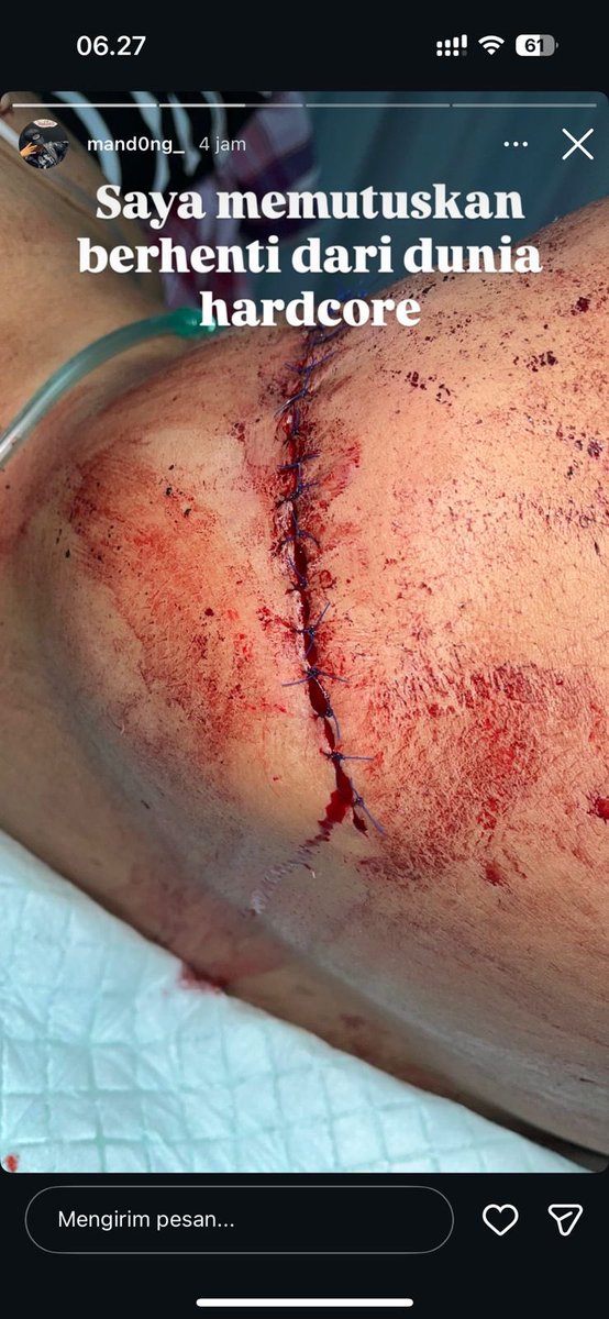 Hc ane arek2 tmbah diluar nalar eh