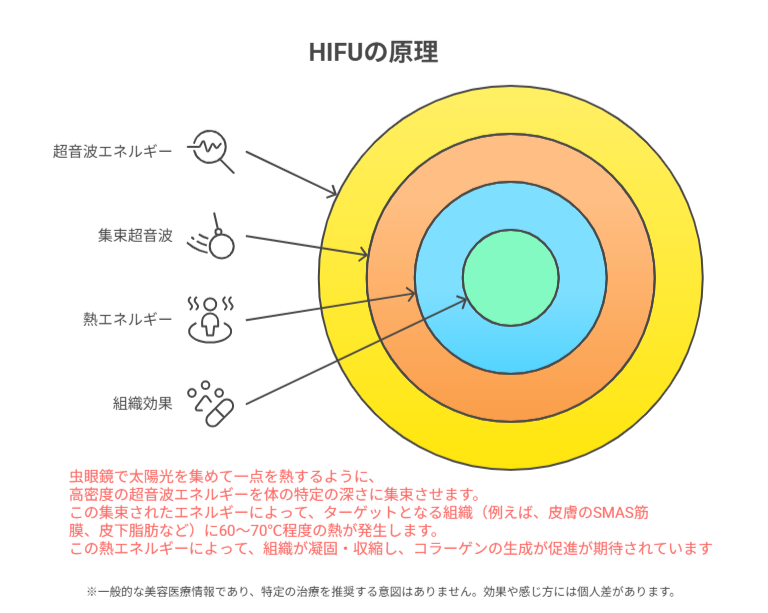 biyojob's tweet photo. 🌸 いまさら聞けない美容情報 🌸

Q. HIFUってよく聞くけど、実際どういうもの？

HIFUは、超音波を一点に集めて皮膚の深い層へ熱刺激を与えることで、引き締めを目的に使われる施術といわれています✨

照射する深さで“目的”が変わるのがポイント📝

#美容医療 #美容看護師 #ハイフ https://t.co/TWEGqGMP6K