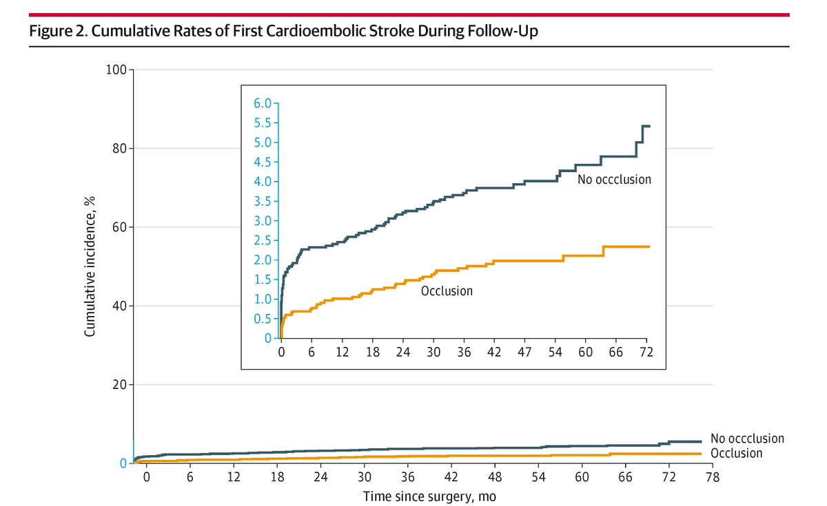 Among patients with AF, surgical occlusion of the left atrial appendage was associated with lower rates of #stroke-related disability and mortality and a decreased proportion of cardioembolic #stroke. ja.ma/49ndH6D