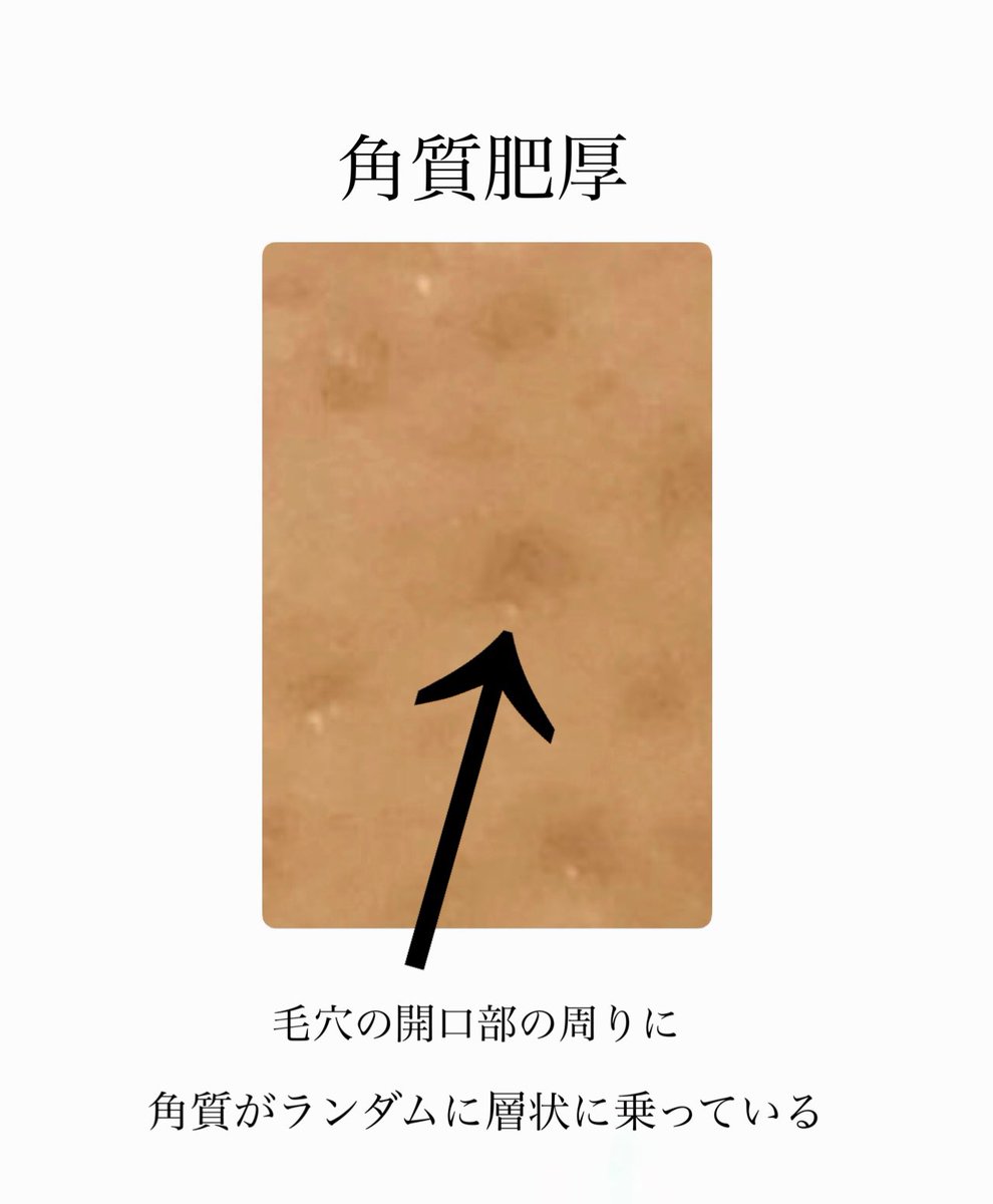 皮膚生理学で導く肌質改善｜えび tweet media