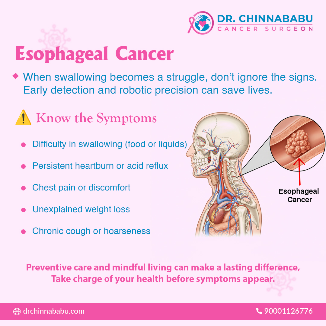 drchinnababu's tweet image. Esophageal cancer starts with small symptoms that many people ignore.
If you have trouble swallowing, acidity or sudden weight loss, please get checked early.
Early detection can save lives.
Stay aware and stay healthy.
#Drchinnababu #EsophagealCancer #RoboticSurgeon #Oncologist