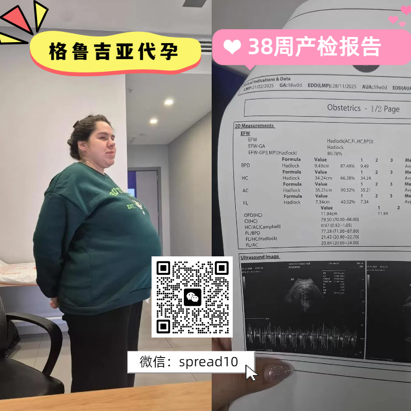 surrogacy2108's tweet photo. 海外 #代孕 ，无需结婚证
最快一年半抱娃，分期付款
可以自��选择性别，双胎等
非常多漂亮 #卵妹 ，挑到满意为止~
欢迎微信了解：spread10 https://t.co/BoCF2573jj