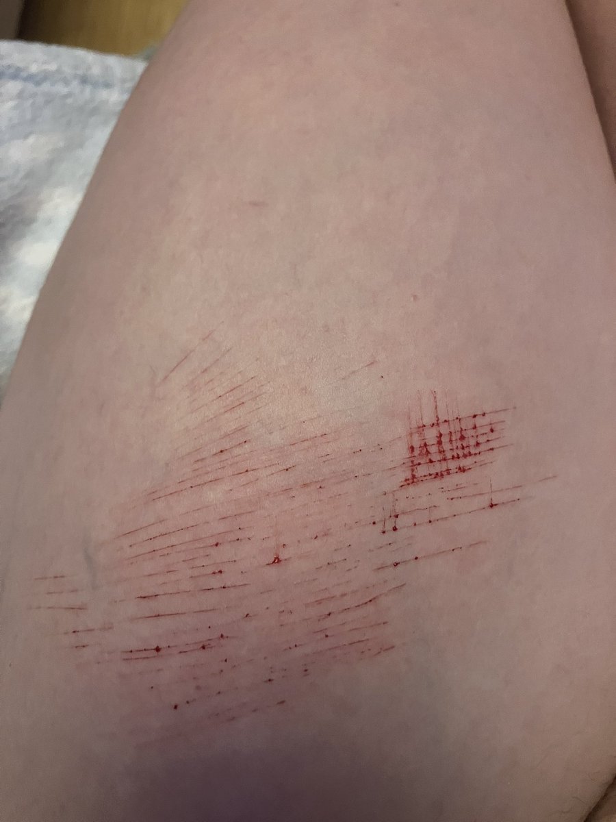 TangyLemon10's tweet photo. (this is for shtwt not edtwy)

i went 1500cal over my limit so we had a tiny sesh

i feel so bad my bubba talked to me for 20+ munutes till i slept then he needed me and i wasnt there, worst gf ever (◍•ᴗ•◍)♡ ✧*。 https://t.co/tQYCuaSlot