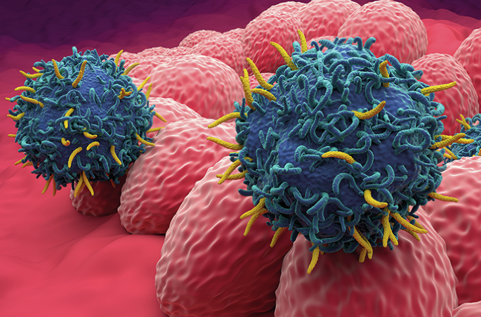 natrevbioeng's tweet image. CAR T cell therapy in solid tumour-on-a-chip bit.ly/4oUvVkH
