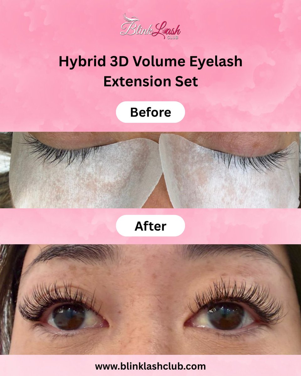 Blinklashclub's tweet image. Check out these stunning results from our Hybrid 3D Volume Eyelash Extensions — fuller, fluffier, and flawlessly natural. 💖
📍 Visit us at: 321 Bleecker St, New York, NY 10014
📞 Call: +1 646 858 0398 | +1 718 249 9327
#BlinkLashClub #EyelashExtensions #HybridLashes