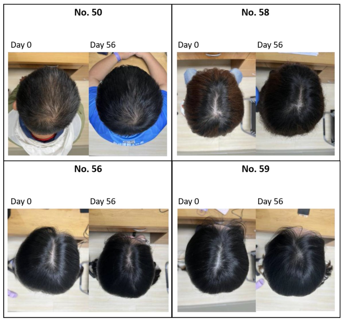 #OpenAccess #Article

📑Title: #Centella asiatica L. Urb. #Extracellular Vesicle and Growth Factor Essence for #Hair and #Scalp Health: A 56-Day Exploratory Randomized Trial 

Authors: Tsong-Min Chang et al.

📌  brnw.ch/21wXyIi