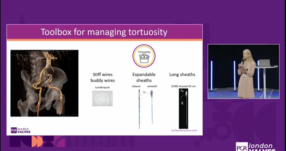 Zill_cardio's tweet image. Role of preprocedural CT in assessment &amp;amp; management of access site complications in patient undergoing transfemoral TAVI 

Preprocedural CT helps to assess :

Vessel Caliber 
Vessel Tortuousity
Distribution of Ca
Optimal puncture site 
Alternative Access 

#TAVR #Imagefirst #1/3