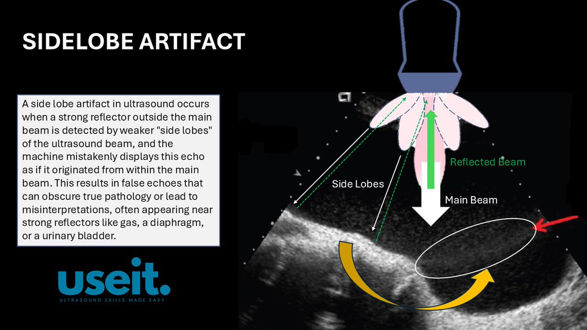 pocus_today's tweet image. #useit
#POCUS