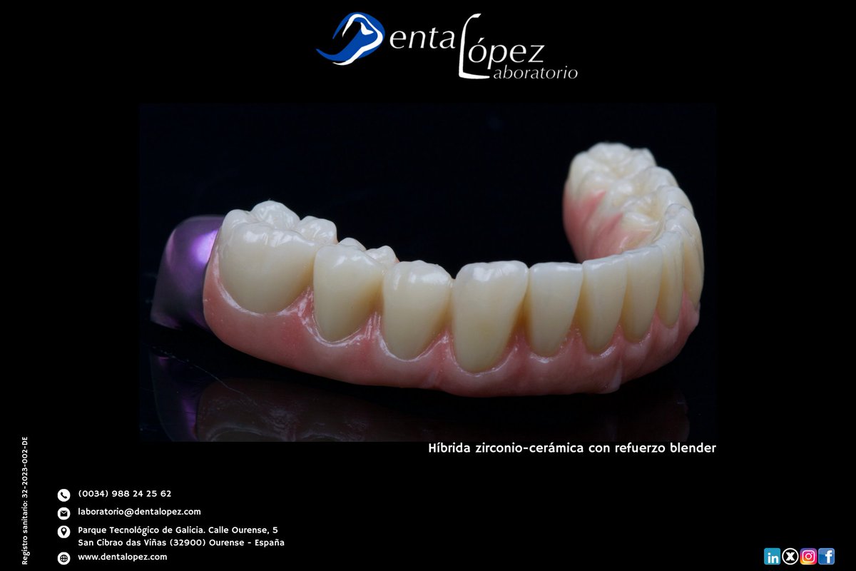 DentaLopez's tweet photo. Esta híbrida zirconio–cerámica con refuerzo Blender está pensada para ofrecer resistencia real y una estética sólida en cada caso.
#DentaLopez #LaboratorioDental #ProtesisDental #ZirconioCeramica #HibridaDental #RefuerzoBlender #OdontologiaDigital #DentalLab #ProtesisDeCalidad https://t.co/kxtMC61msy