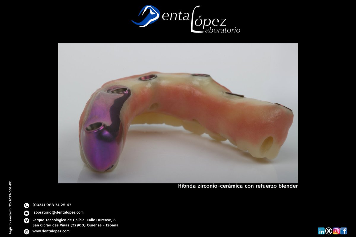 DentaLopez's tweet photo. Esta híbrida zirconio–cerámica con refuerzo Blender está pensada para ofrecer resistencia real y una estética sólida en cada caso.
#DentaLopez #LaboratorioDental #ProtesisDental #ZirconioCeramica #HibridaDental #RefuerzoBlender #OdontologiaDigital #DentalLab #ProtesisDeCalidad https://t.co/kxtMC61msy