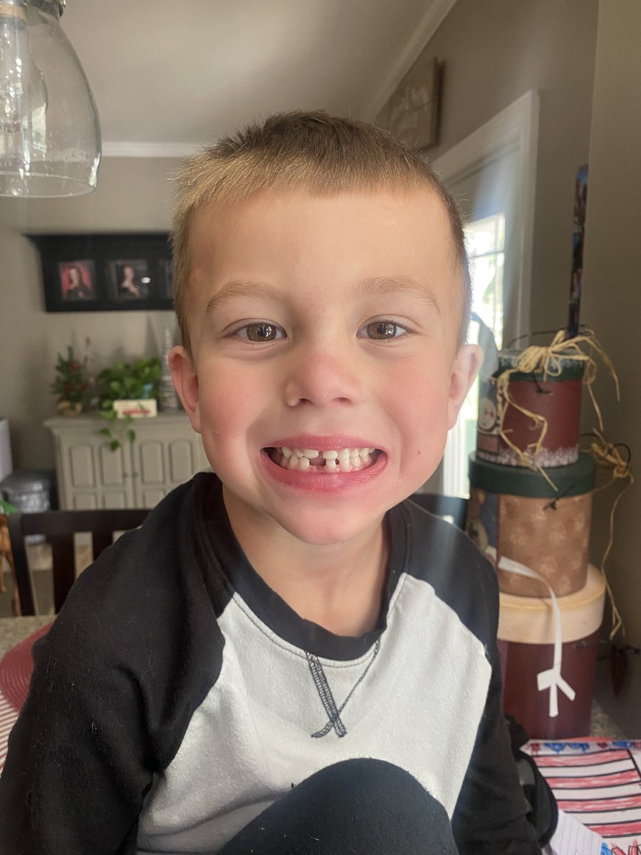 sammylaws's tweet photo. Lost his first tooth by wrestling and getting bowed by his brother. Amazing https://t.co/RzFQoARMyH