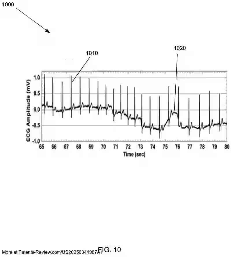 PatentPulse's tweet image. New patent application #US20250344987A1 by #BiosenseWebster explores reducing noise in intracardiac ECGs using a denoised #autoencoder. 

The system refines ECGs with #DeepLearning, enhancing signal clarity by encoding and decoding raw data to remove noise. 

Key features include…