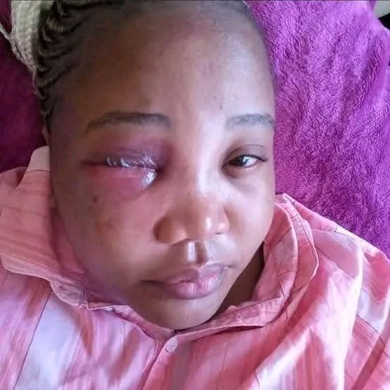 This is Namhla Mtwa,From Sdwadwa Mthatha 9 Bullets where pumped into her body on the 21 April 2022 by her Boyfriend Mfesane Bekezulu,He still hasn't been arrested and roaming the streets free, Shadrack Sibiya made the Dockets to dissappear as said at the #MadlangaCommission