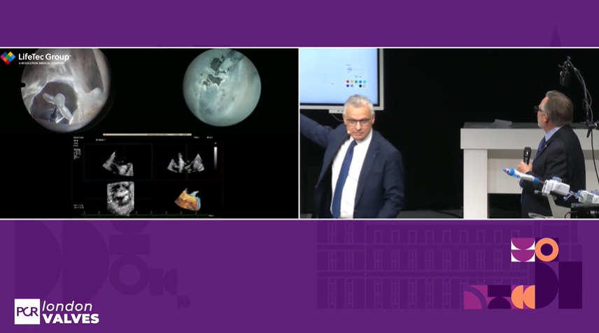 Zill_cardio's tweet image. #HappeningNow at #PCRLV

Simulation based learning on optimal procedural techniques in Tricuspid TEER 

#T_TER @PCRonline @APSIC6