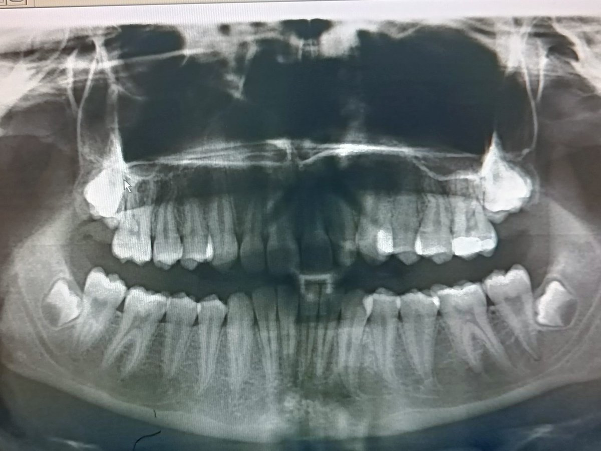 La foto de mis vacaciones…