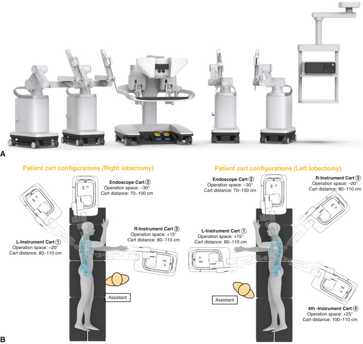 AATSHQ's tweet image. New #thoracic research: This study presents the first clinical application of a novel modular robotic system for robot-assisted anatomical lung resection. See details in #JTCVS Techniques: doi.org/10.1016/j.xjtc…