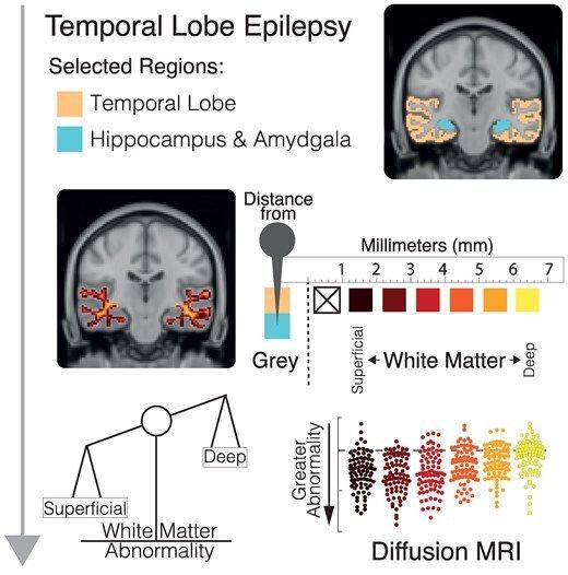 braincomms's tweet image. Hall et al. investigate whether fractional anisotropy abnormality in temporal lobe white matter is spatially homogenous at differing depths in drug-resistant temporal lobe epilepsy. Full article 👉  buff.ly/wJhSphi #epilepsy