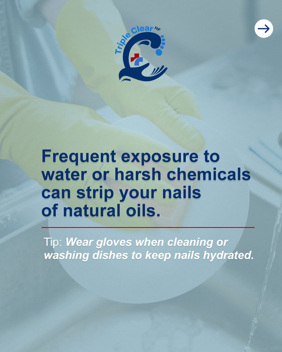 TripleClearHF's tweet image. Peeling nails? 💅

Harsh cleaners and overuse of polish strip strength and moisture.

Triple Clear HF treats and protects naturally for smoother, stronger nails.

Coming soon in early November!

#TripleClearHF #NaturalNailCare #HealthyNails