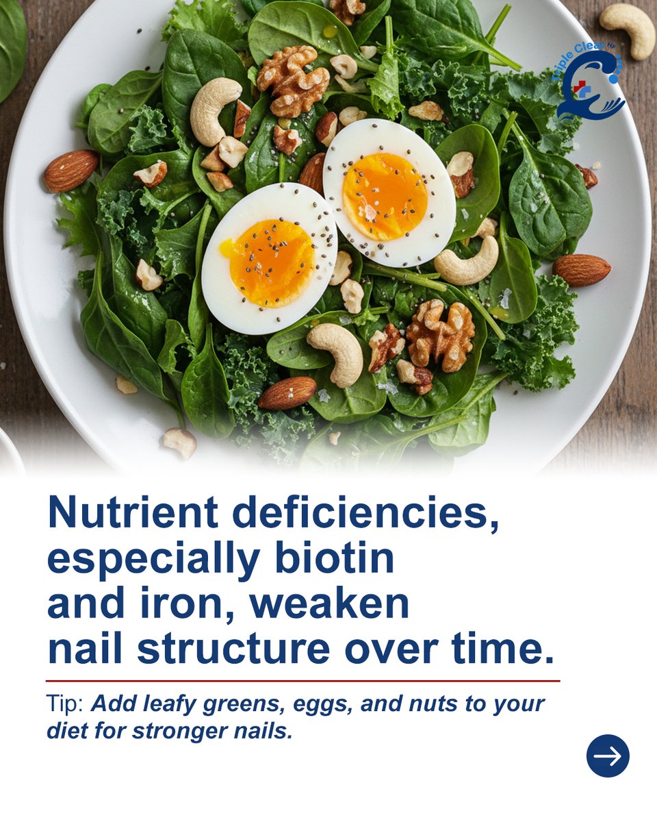 TripleClearHF's tweet image. Peeling nails? 💅

Harsh cleaners and overuse of polish strip strength and moisture.

Triple Clear HF treats and protects naturally for smoother, stronger nails.

Coming soon in early November!

#TripleClearHF #NaturalNailCare #HealthyNails