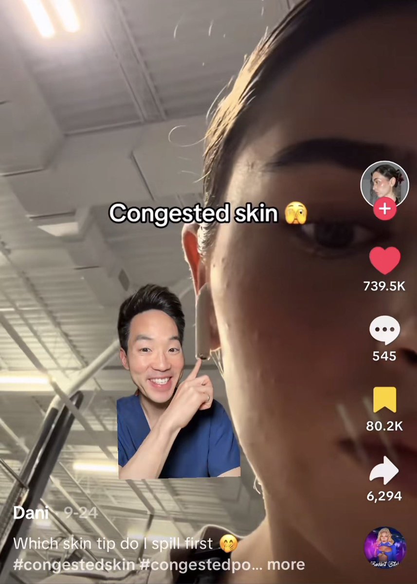 Nananblogblog's tweet image. ปัญหาผิวไม่เรียบ สิวผด สิวอุดตันฉ่ำ ลองทำตามหมอผิวหนังท่านนี้ดู นี่ลองละว่ามันเวิร์มากเลย  
ใช้คลีนเซอร์ที่มีส่วนผสม aha/bha ลดสิว 
ใช้เรตินอลขนาดเท่าเม็ดถั่วเขียวในตอนกลางคืน 
ใช้มอยส์เนื้อเบาทาผิวสม่ำเสมอเช้า-เย็น 
ใช้ผลิตภัณฑ์ผลัดเซลล์ผิวสัปดาห์ละ 1…