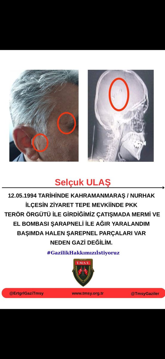 <a href="/ozgurceylanchp/">Özgür CEYLAN</a> Gazilik hakkı yolunda kararlılıkla yürüyen bizlere destek ve umut veren Sn.<a href="/ozgurceylanchp/">Özgür CEYLAN</a> Vekilimize teşekkür ederiz.
#GazilikHakkımızıİstiyoruz
<a href="/eczozgurozel/">Özgür Özel</a>
<a href="/YankiBagcioglu/">Yankı Bağcıoğlu</a>
<a href="/drmetinilhan40/">Dr. Metin İlhan</a>
<a href="/CHPMuratBakan/">Murat BAKAN</a>