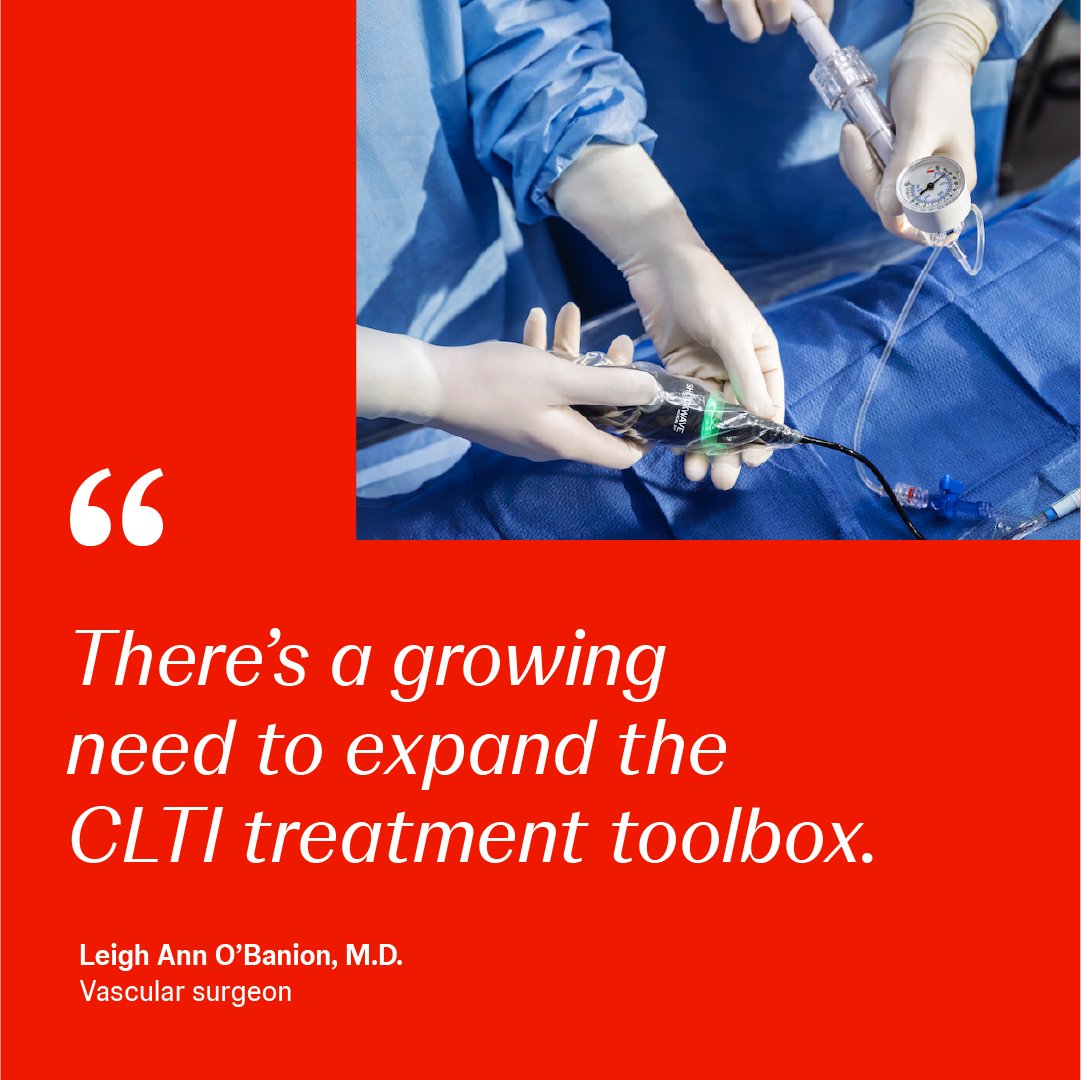 JNJMedTech's tweet image. We need to reimagine how we approach addressing chronic limb-threatening ischemia (CLTI). 

We sat down with Dr. Lee Ann O’Banion to discuss an innovative tool designed to help bridge the CLTI treatment gap. 

Read the full article here: bit.ly/3Lpc1PT